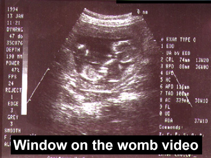 When does life begin? Window on the womb video